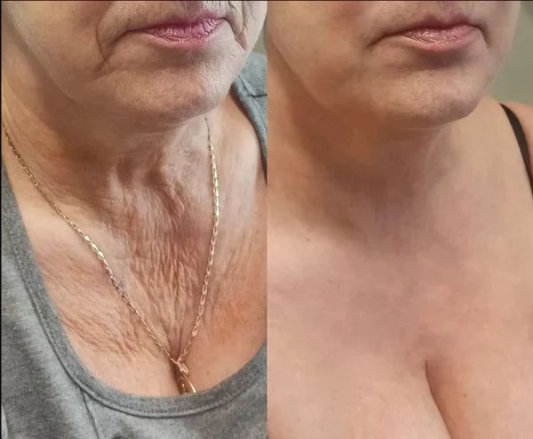 Before and after GlowLift transformation